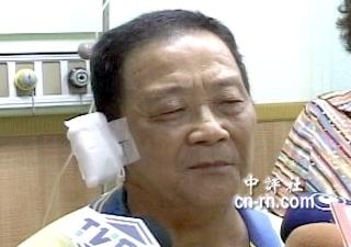 被民進(jìn)黨籍議員盧同協(xié)砸傷的災(zāi)民。電視截圖