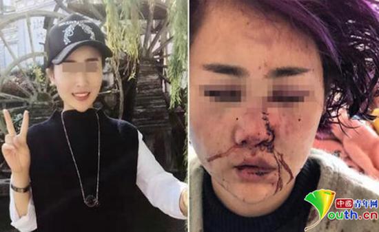 女孩被打毀容前后對比照。