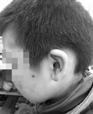 南京遭虐待男童稱因撒謊被打不怪繼母 南京遭虐待男童稱因撒謊被打不怪繼母